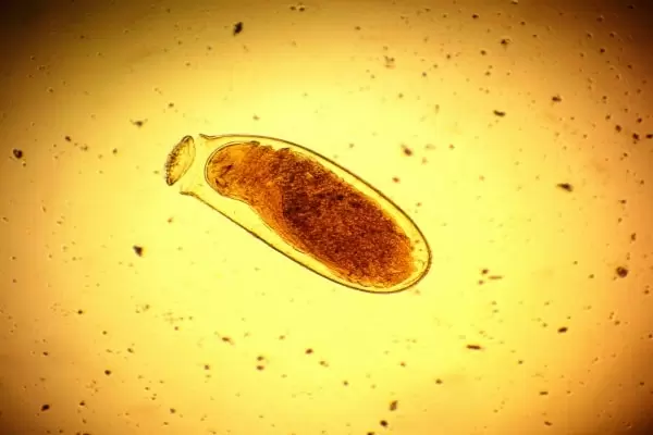 Фото яйца постельного клопа под микроскопом