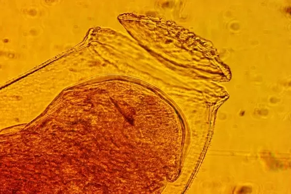 Фото яйца клопа под микроскопом