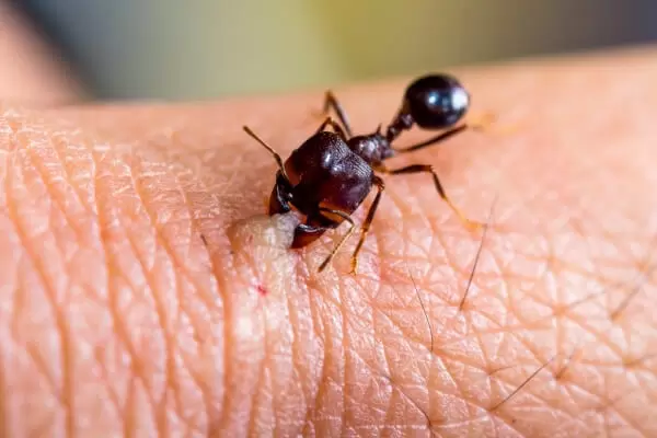 Укусы муравьев на человеке фото