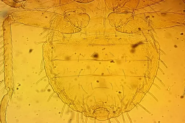 Как выглядит брюхо личинки постельного клопа под микроскопом