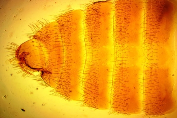 Фото брюха постельного клопа под микроскопом