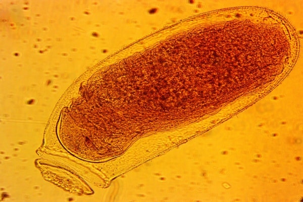 Яйца клопов постельных фото под микроскопом