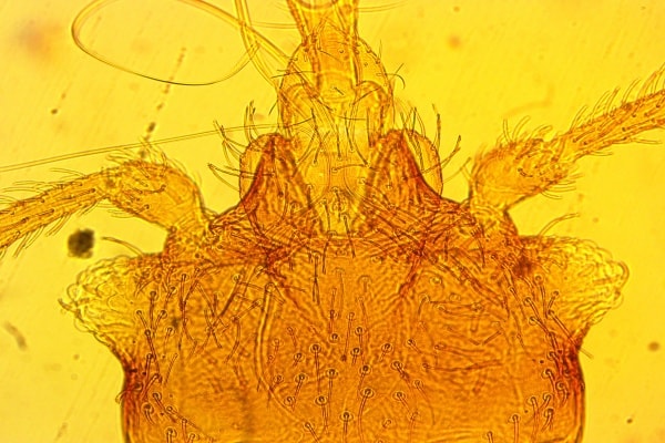 Фото головы постельного клопа под микроскопом
