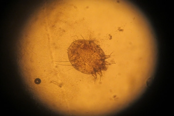 Фото чесоточного клеща под микроскопом