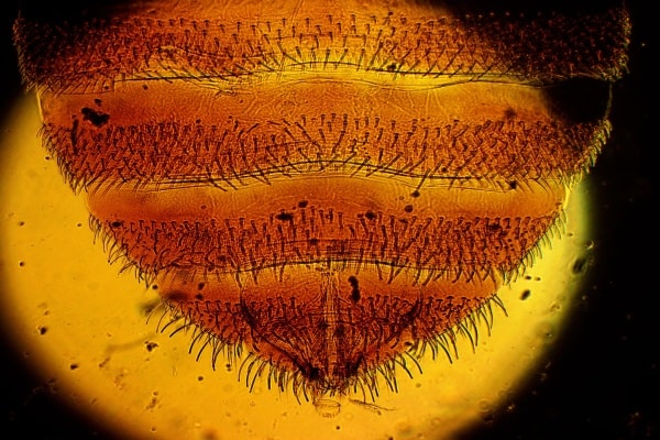 Как выглядит брюхо постельного клопа под микроскопом