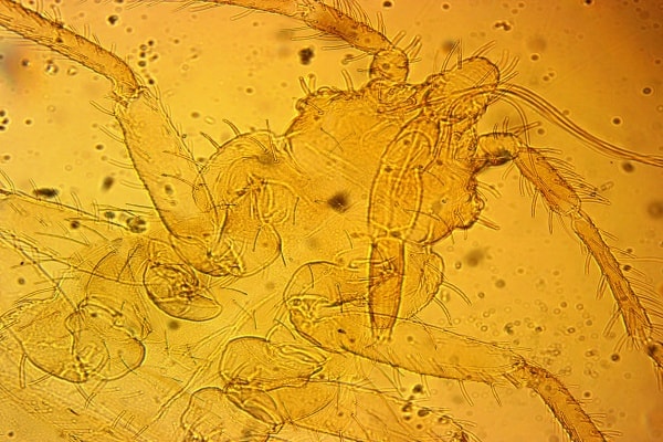 Тело личинки постельного клопа под микроскопом