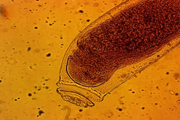 Яйцо постельного клопа под микроскопом