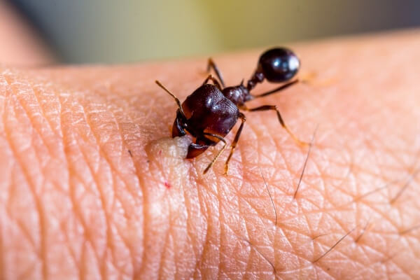 Укусы муравьев на человеке фото
