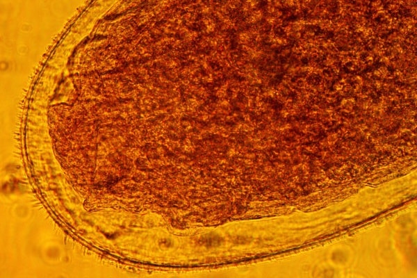 Яйцо клопа под микроскопом