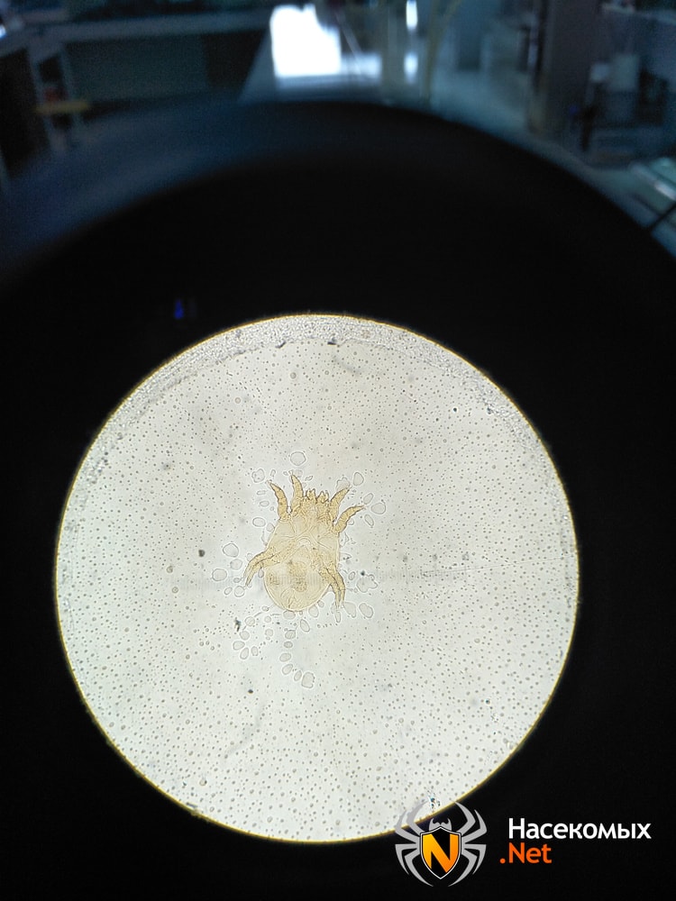 Пылевой клещ под микроскопом фотография